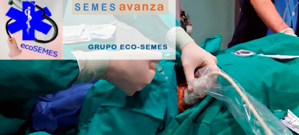 Grupo ECO-SEMES